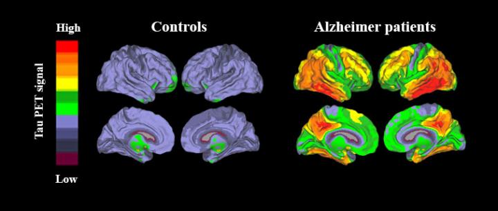 New method enables accurate diagnosis of |