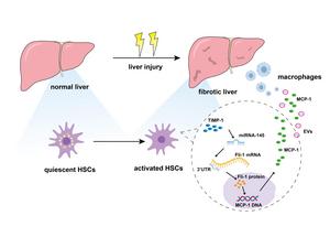 TIMP-1 Promotes Expression of MCP-1 and Macrophage Migration by Inducing Fli-1 in Experimental Liver Fibrosis