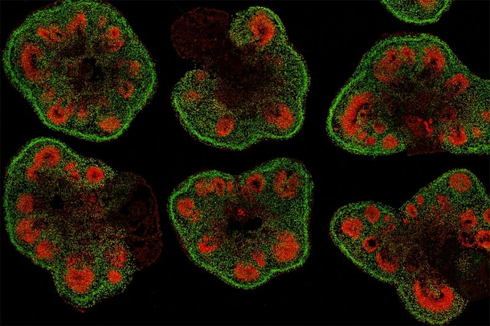 Slices of mini–brain organoids with neural stem cells (red) and cortical neurons (green).