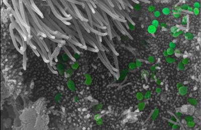 Bacteria in the Respiratory Tract