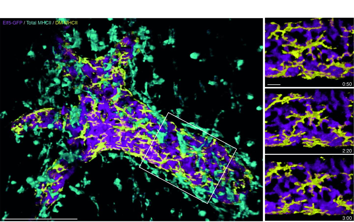 Breast duct immune cells