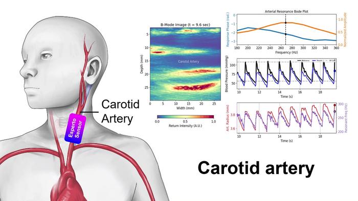 Resonance Sonomanometry Human Data