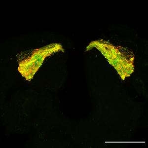 Fruit fly brain