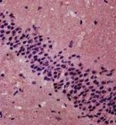 Capsule Medicine Powder