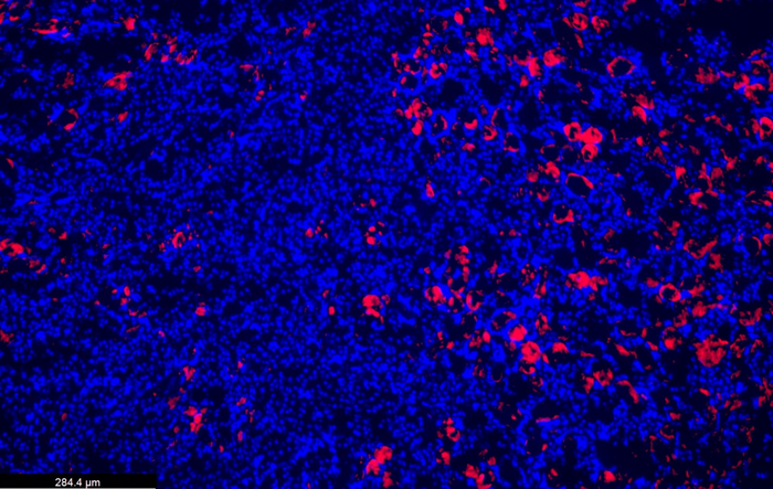 cellules rénales infectées