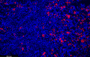 Cells in injured kidney