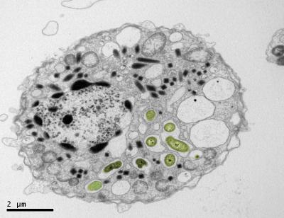 Parasitic Dinoflagellates of the Genus <i>Hematodinium</i>