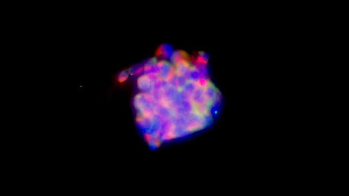 Liver Cancer Stem-Like Cells