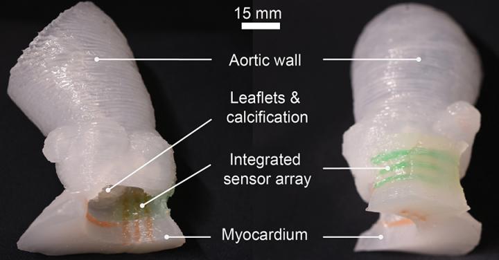 Aortic root models Image