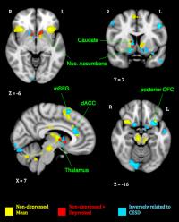 Brain Responses to Crying Infants
