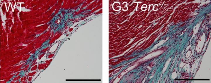 Shorter Telomeres Impair Heart Regeneration