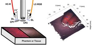 Detailed optical property maps of biological tissues result from a newly developed laparoscopic imaging device that integrates stereo depth estimation and speckle-illumination spatial frequency domain imaging (si-SFDI).