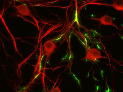 TREK1 Neurons