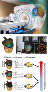 Virtual Epileptic Patient and PCI-Method for measuring consciousness levels