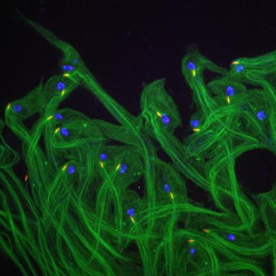 Fruit Fly Sperm Cell Tails