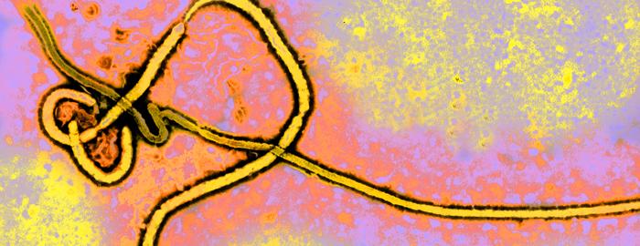 Ebola Photomicrograph
