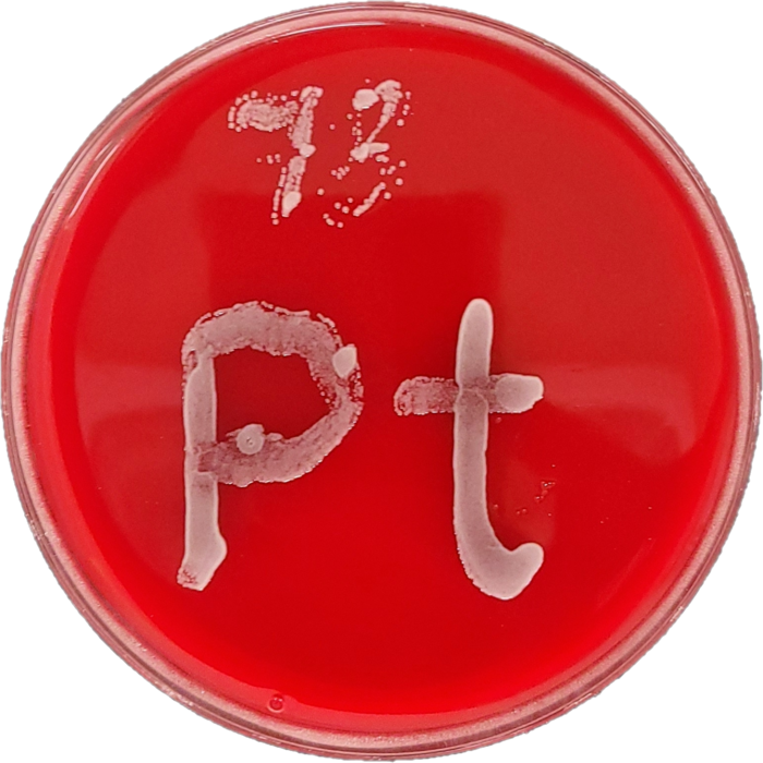 A Petri dish with red agar on [IMAGE] EurekAlert! Science News Releases