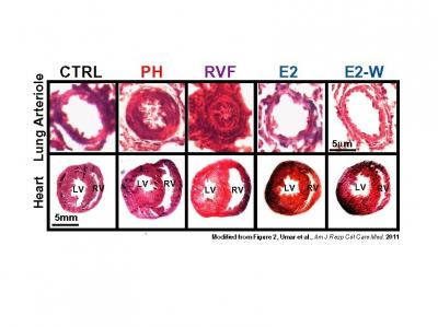 Reversal of Diseased Pulmonary and Heart Structure with Estrogen Treatment