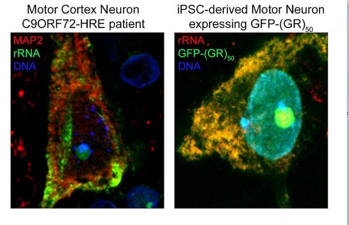 New therapeutic strategy to reduce neuronal death in amyotrophic lateral sclerosis