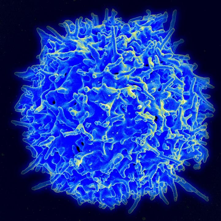 Scanning Electron Micrograph of a Human T Cell