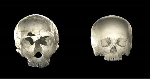 Neandertal and Human Cranium