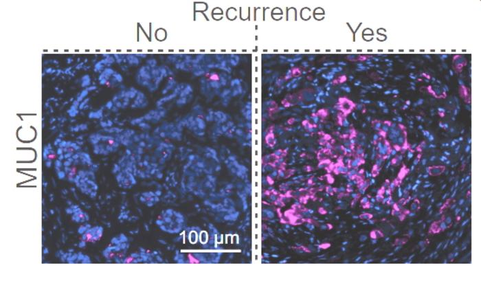 Genes that help cancer cells grow