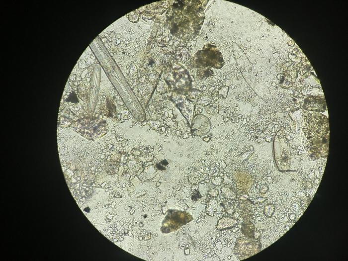 Diatoms