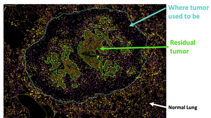 Multiplex immunofluorescence image