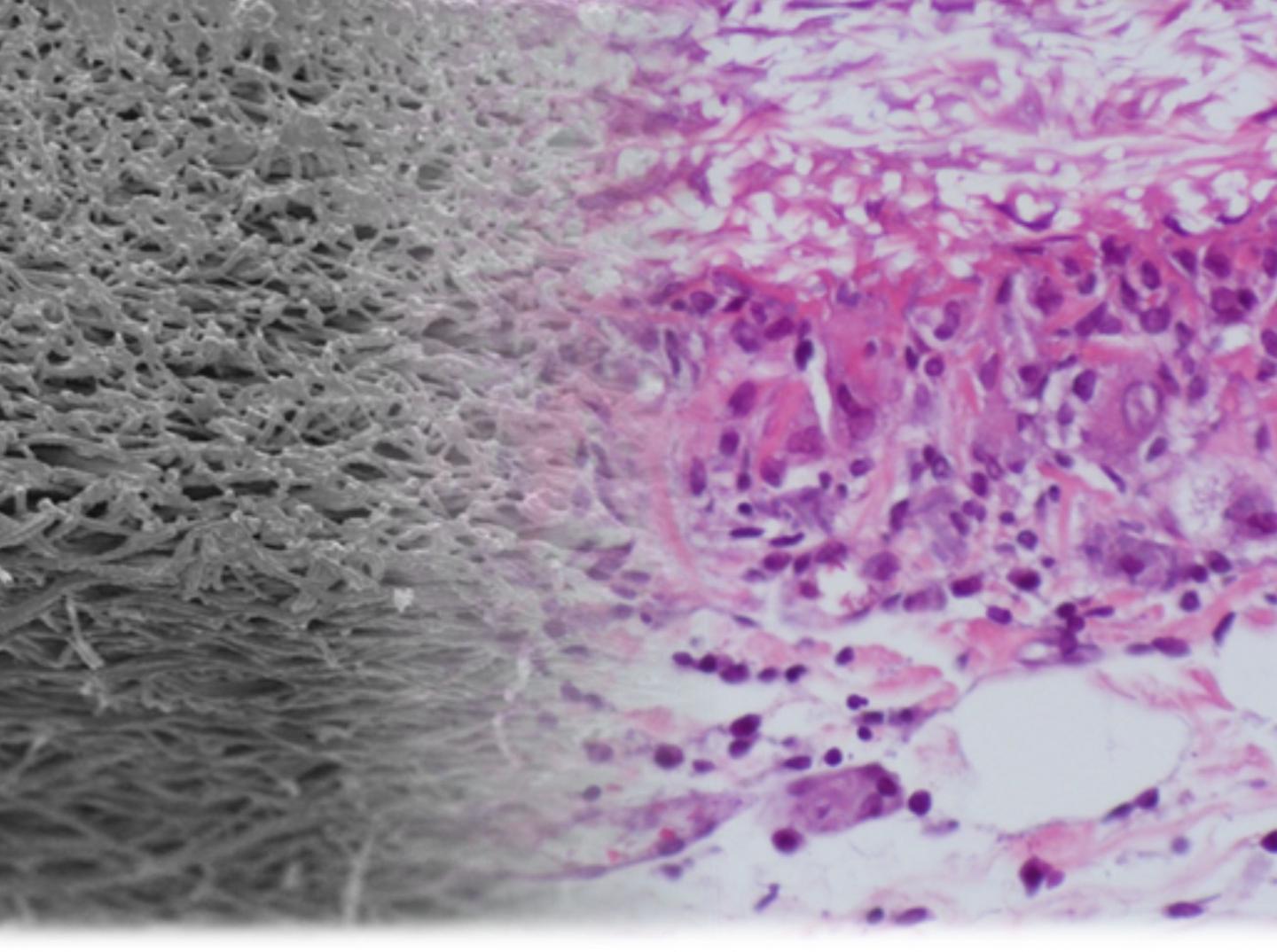 Combination of Materials