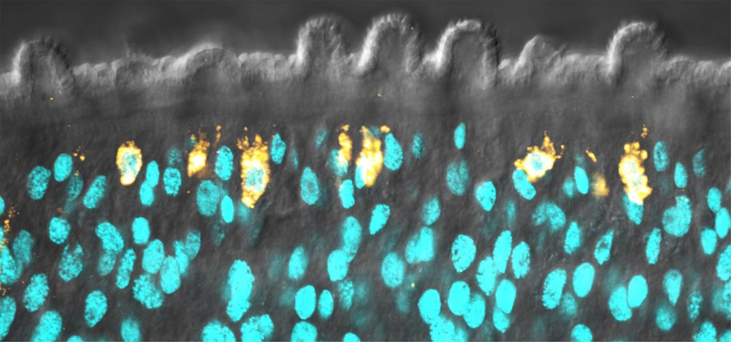 Schistosome Skin with Newly Born Cells Underneath