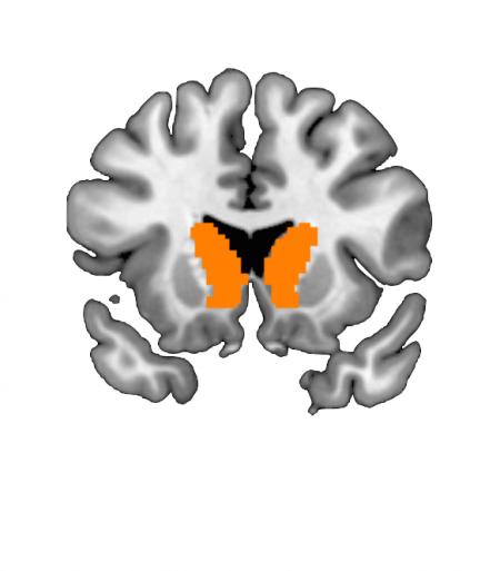 A Region of the Brain Called the Caudate Nucleus Responding to Risk