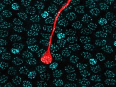 Fovea Photoreceptor Cell Micrograph