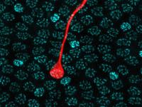 Fovea Photoreceptor Cell Micrograph