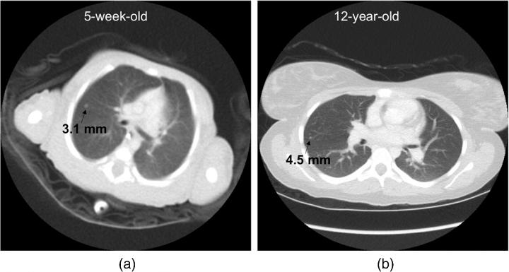 Fig 3: Effect of Reconstruction FOV Size on the Displayed Diameter of a Nodule