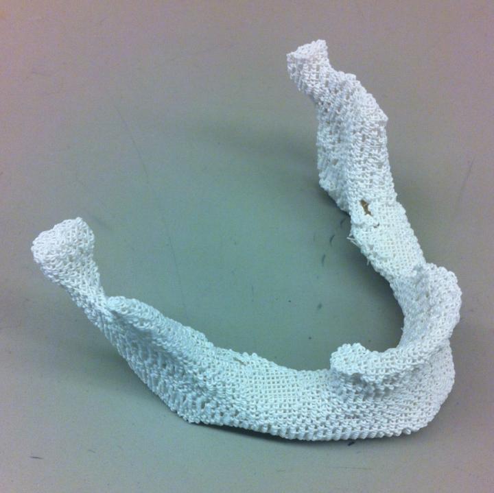 A 3-D Printed Jaw