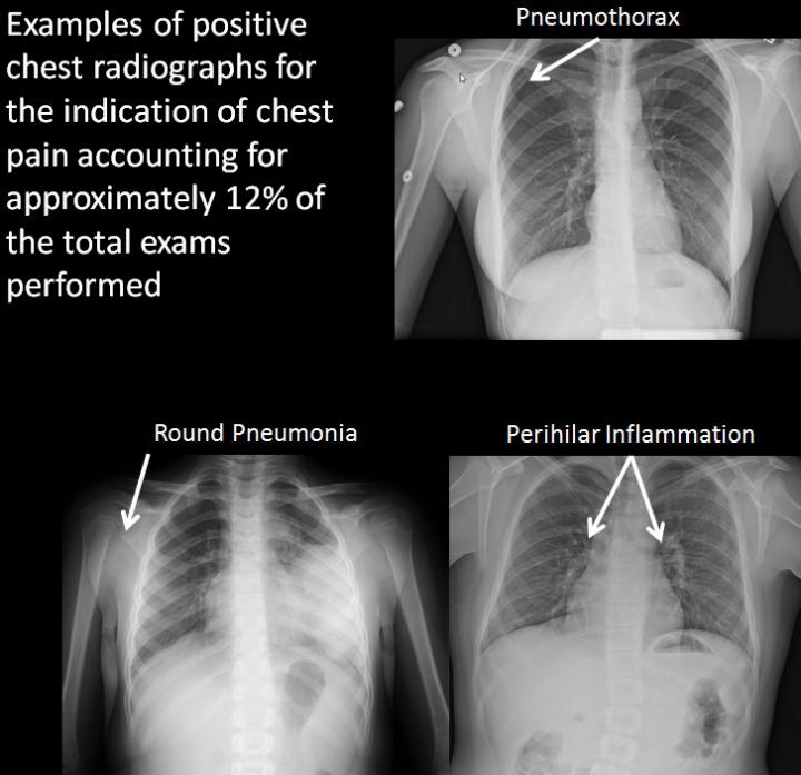 Examples of Positive X-rays