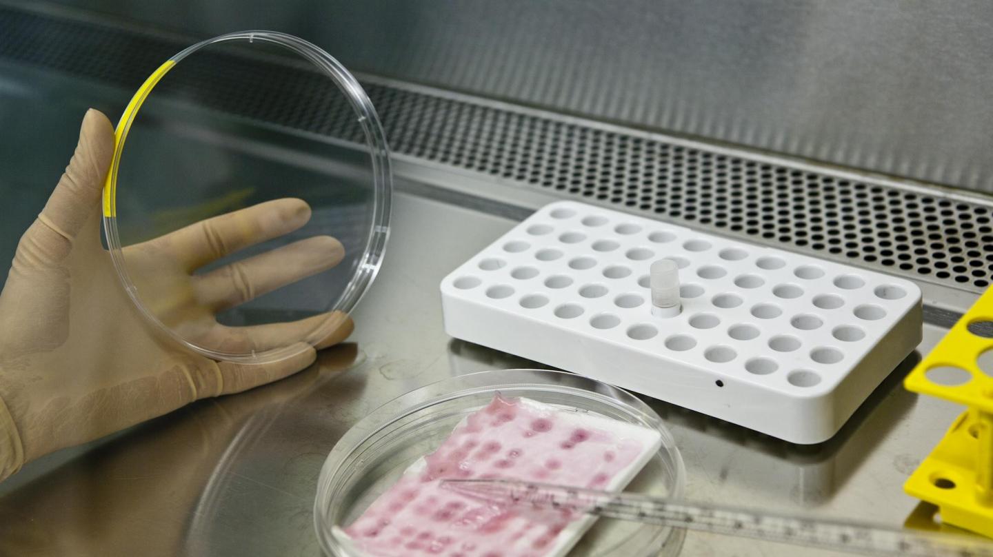 Infection-Fighting Bandage for the Treatment of Severe Burns (2 of 3)