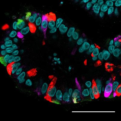 Intestinal Organoid with Hormone-Producing Cells