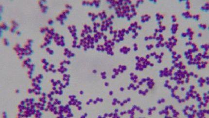 The Micromorphology of Bacterial Strain <em>Lactococcuslactis subsp. lactis</em>
