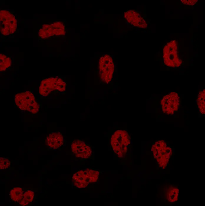 Triple negative breast cancer cells