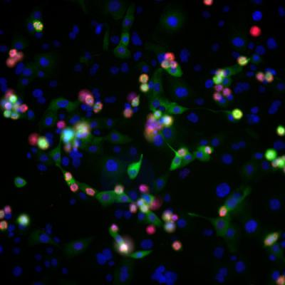 Drug Resistant Ovarian Cancer Cells