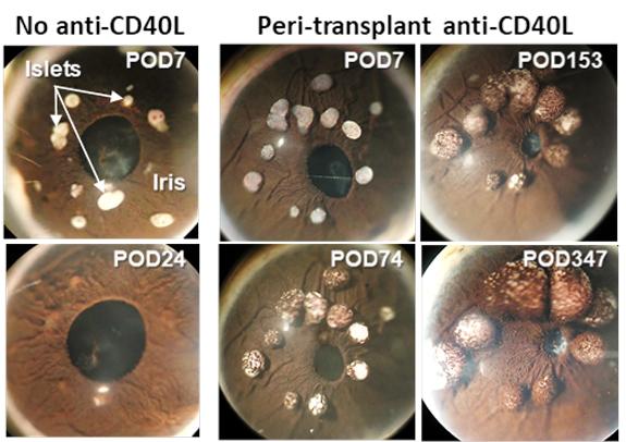 Long-Term Survival of Intraocular Islet Transplants