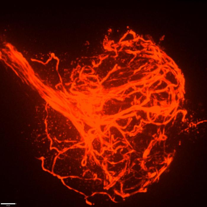 Tangled tubules