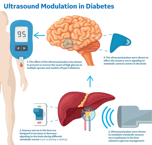 Ultrasound Modulation In Diabetes