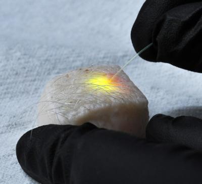 Intracelluar Laser Emits Light from Fat Cells