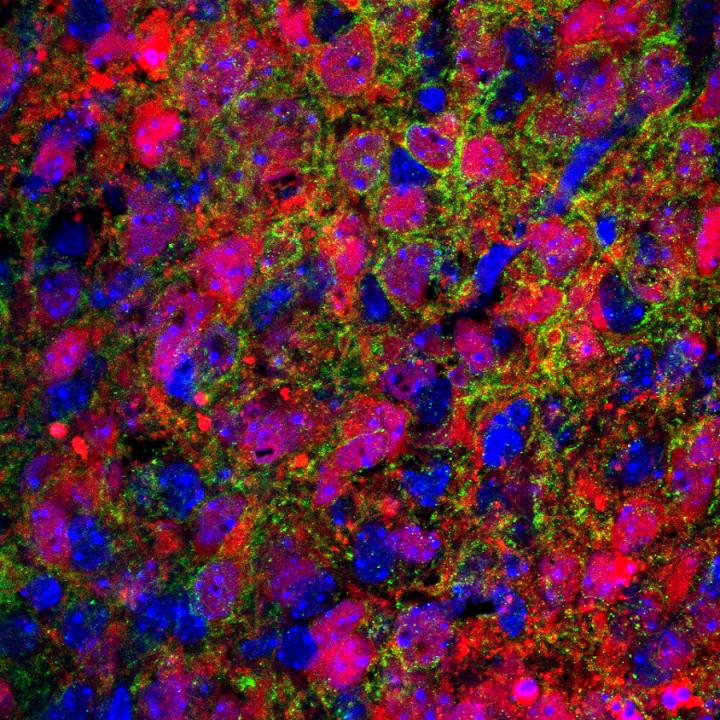 Neurons of the Parabrachial Complex