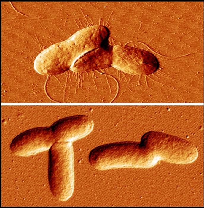 bacteria with and without attachment fimbriae