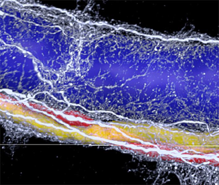 Nerves in fatty liver