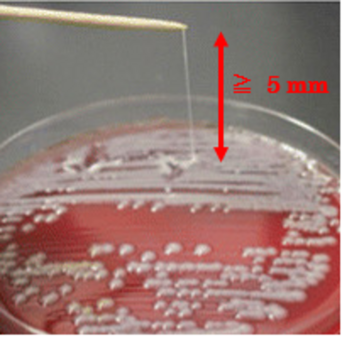 Photo: A hypermucoviscous strain of Klebsiella pneumoniae on a blood agar plate