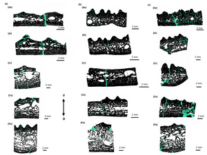 Thin section images of Metoposaurus interclavicles: